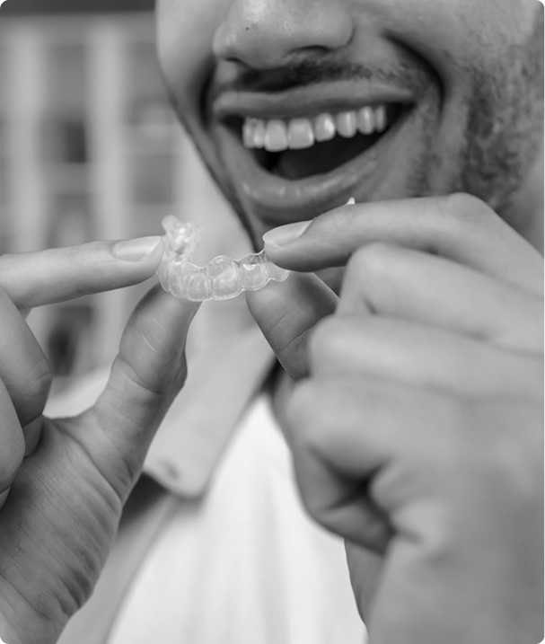 Quels sont les avantages des aligneurs ? Quels sont les avantages des aligneurs ?