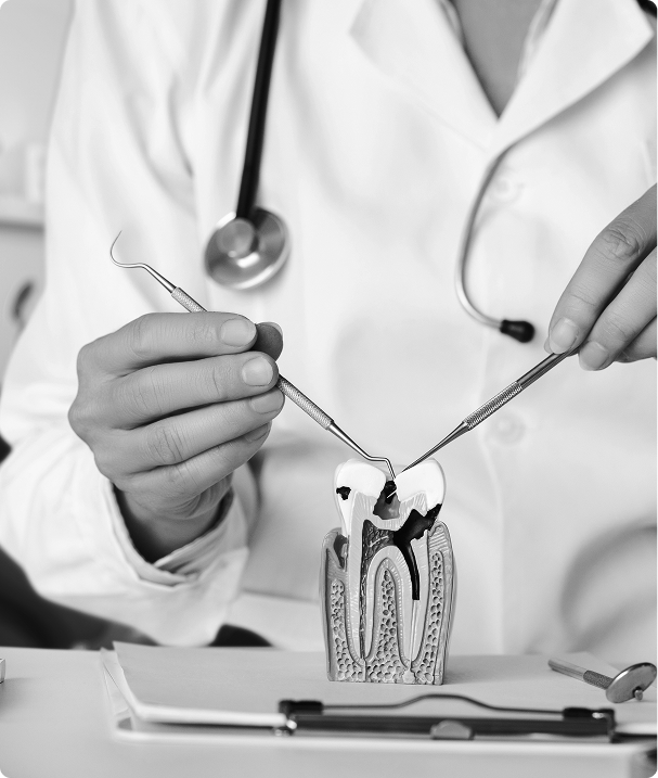 Qu’est-ce qu’un traitement endodontique ? Qu’est-ce qu’un traitement endodontique ?
