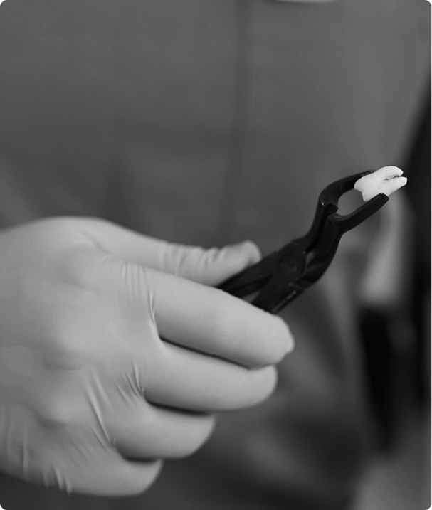 Une intervention fréquente, réalisée avec précision et douceur Une intervention fréquente, réalisée avec précision et douceur